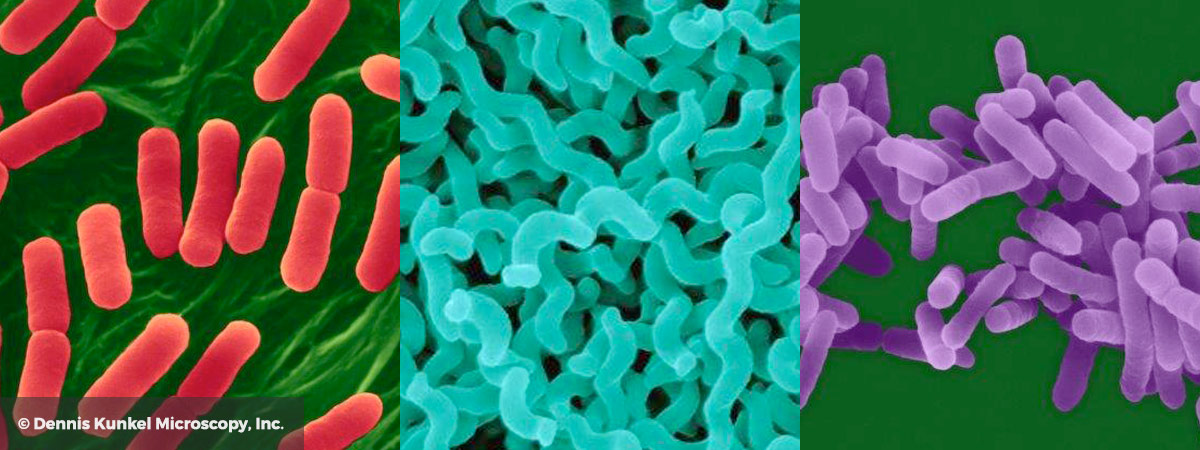 Images of Pathogens by Dennis Kunkel
