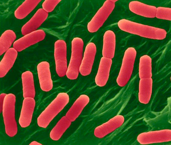 Picture of Picture of E. coli O157:H7, Escherichia coli